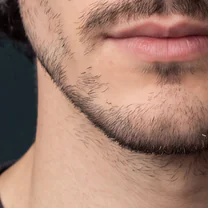 Example close-up: jaw and beard