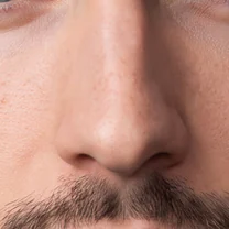 Example close-up: nose