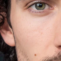 Example close-up: skin